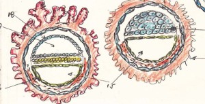 Placenta y Mola Hidatiforme 1 PDF