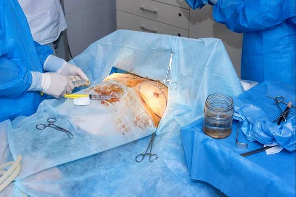 What Sets Breast Reconstruction Specialists of NYC Apart from Others